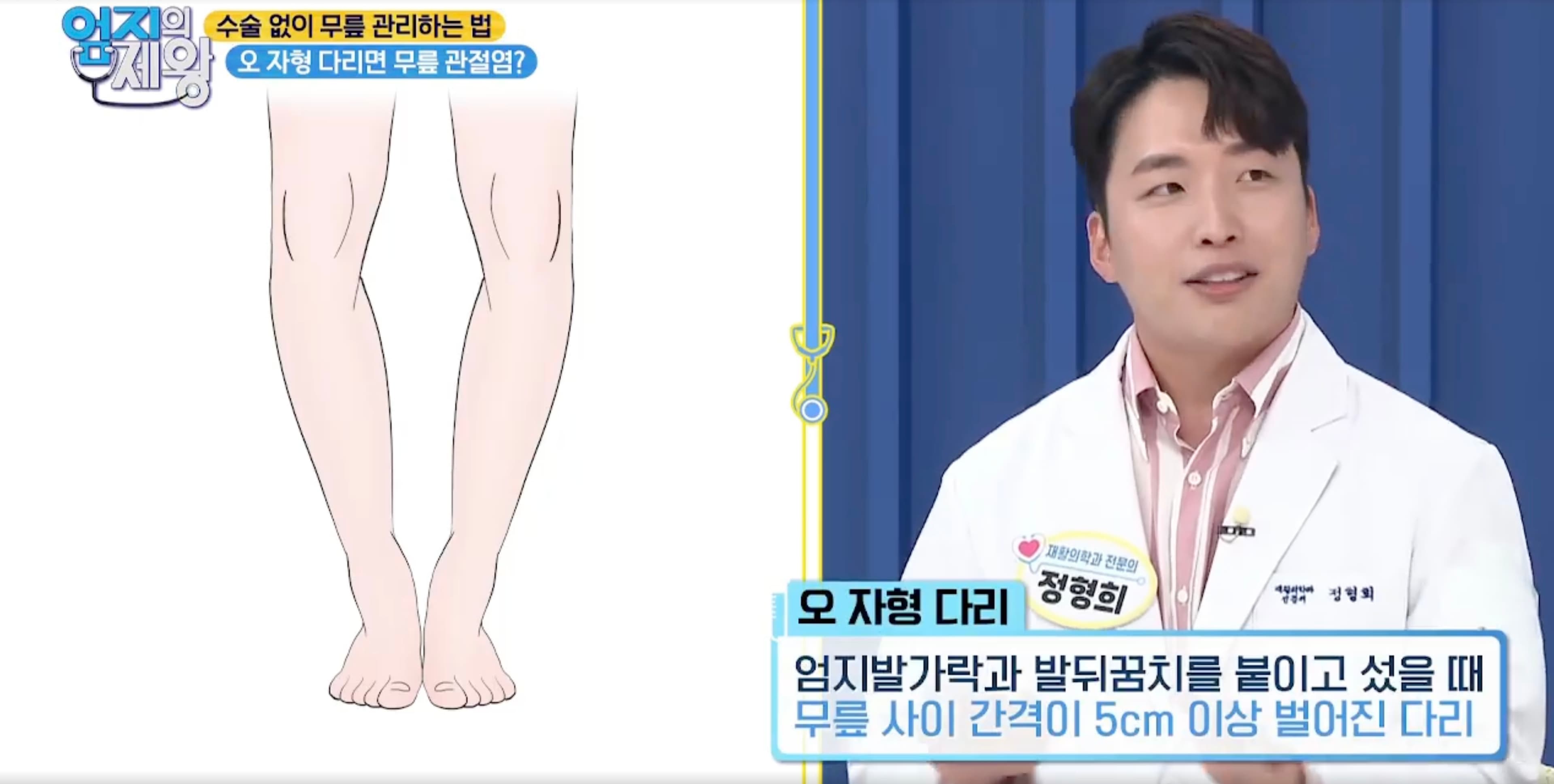 MBN 엄지의 제왕에서 무릎관절염의 원인과 관리 방법을 설명하는 정형희 원장