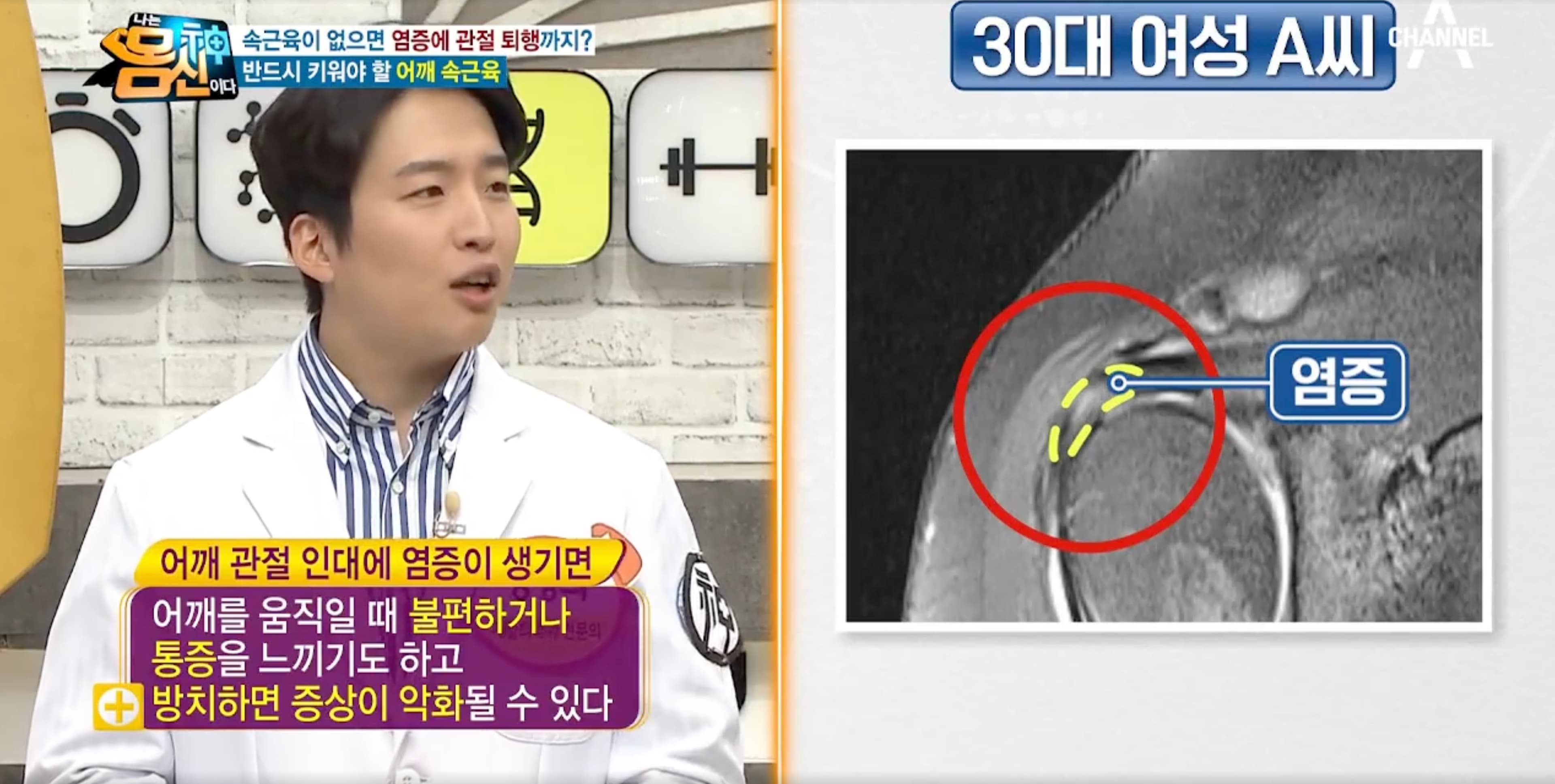 무릎과 어깨 관절을 지지하는 근육의 역할을 설명하는 나는 몸신이다 방송 장면